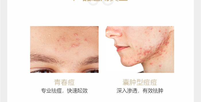 ؐ��ޱԊ�������R�����ȡ�С���z��