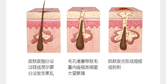 ؐ��ޱԊ�������R�����ȡ�С���z��